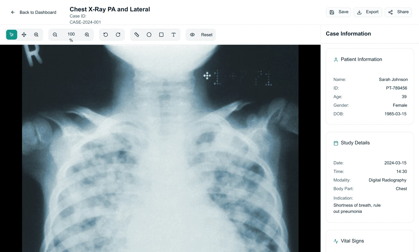 Medical imaging platform testing phase 5